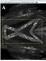 Quantification of Neuromuscular Junctions in Zebrafish Cranial Muscles