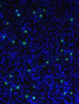 Development and Validation of Chlamydia muridarum Mouse Models for Studying Genital Tract Infection Pathogenesis