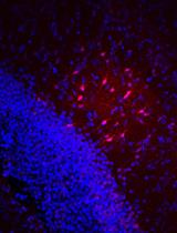 急性小鼠大脑切片中缝隙连接介导的星形胶质细胞耦合可视化