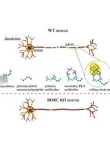 Puromycin Proximity Ligation Assay (Puro-PLA) to Assess Local Translation in Axons From Human Neurons