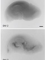 Monitoring Changes in Intracellular Chloride Levels Using the FRET-Based SuperClomeleon Sensor in Organotypic Hippocampal Slices