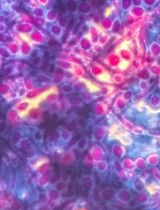 利用 Maneval 染色双重染色法检测和区分微生物生物膜