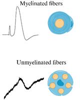 Procedure for Reliable and Long-Lasting Ex Vivo Recordings of Sciatic Nerve Activity in Mice