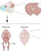 Developing a Ministroke Model in Mouse Barrel Cortex