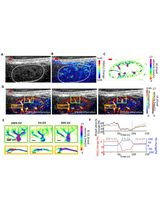 Dual-Modal Fast Photoacoustic/Ultrasound Localization Imaging with Sparsity-Constrained Optimization
