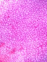 通过 UVA 照射和角膜内皮层手术去除在小鼠角膜中构建 FECD 表型