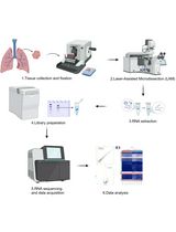A Protocol for Laser-Assisted Microdissection and tRF & tiRNA Sequencing in Lung Adenocarcinoma
