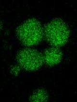 Isolation of In Vitro Osteoblastic-Derived Matrix Vesicles by Ultracentrifugation and Cell-Free Mineralization Assay