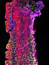 Optimizing Confocal Imaging Protocols for Muscle Fiber Typing in the Mouse Masseter Muscle
