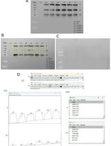 Detection and Analysis of S-Acylated Proteins via Acyl Resin–Assisted Capture (Acyl-RAC)