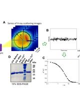 X-Ray Photon Correlation Spectroscopy, Microscopy, and Fluorescence Recovery After Photobleaching to Study Phase Separation and Liquid-to-Solid Transition of Prion Protein Condensates