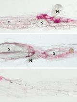 Image-Based Lignin Detection in Nematode-Induced Feeding Sites in Arabidopsis Roots