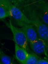 TurboID Labeling and Analysis of Proteins in the Primary Cilium
