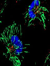 Stable 13C-glutamine Tracing Resolved Metabolomics for Cancer Metabolism Study