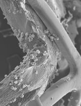 Quantifying Thrombogenicity: A Bioanalytical Protocol for the Absorbance-Based Assessment of Vascular Implants with Plasma