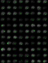 From Bedside to Desktop: A Data Protocol for Normative Intracranial EEG and Abnormality Mapping