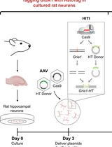 Single-Particle Tracking of AMPA Receptor-Containing Vesicles
