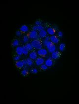 An Automated Imaging Method for Quantification of Changes to the Endomembrane System in Mammalian Spheroid Models