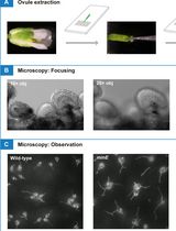 Using a Live Analysis System to Study Amyloplast Replication in Arabidopsis Ovule Integuments