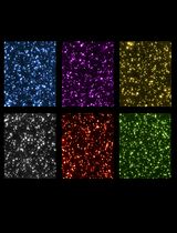 In vitro Condensation Assay of Fluorescent Protein-Fused PRPP Amidotransferase Purified from Budding Yeast Cells