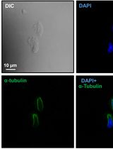 精子伸长期鞭毛套结构免疫荧光分析的睾丸细胞制备方法