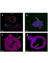 The Establishment of 3D Polarity-Reversed Organoids From Human Endometrial Tissue as a Model for Infection-Induced Endometritis