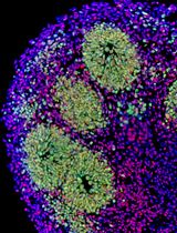 A Hybrid 2D/3D Approach for Neural Differentiation Into Telencephalic Organoids and Efficient Modulation of FGF8 Signaling