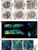 Construction of Large Cranial Windows With Nanosheet and Light-Curable Resin for Long-term Two-Photon Imaging in Mice