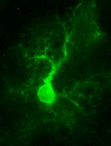 Two-photon (2P) Microscopy to Study Ca<sup>2+</sup> Signaling in Astrocytes From Acute Brain Slices