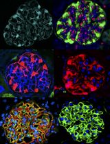 Isolation of Podocyte Cell Fractions From Mouse Kidney Using Magnetic Activated Cell Sorting (MACS)