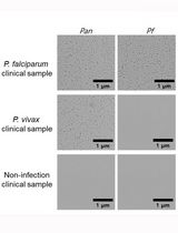 Rapid and Multiplex Diagnosis of Malaria Using Chelex-100 Extraction and LAMP-MS Assay