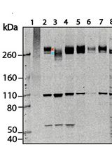Western Blotting and Immunoprecipitation of Native Human PIEZO1 Channels