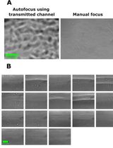 Using Beads as a Focus Fiduciary to Aid Software-Based Autofocus Accuracy in Microscopy