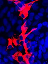 Isolation and Culture of Ferret Airway Stem Cells