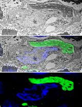 A Step-By-Step Protocol for Correlative Light and Electron Microscopy Imaging of Proteinaceous Deposits in Cultured Cells and Human Brain Tissues