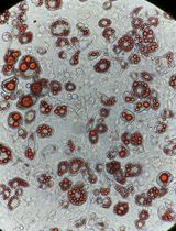 Reprogramming White Fat Cells for Adipose Manipulation Transplantation (AMT) Therapy