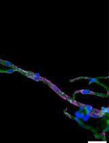 脑组织微血管的分离与成像