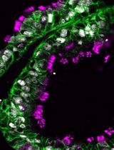 Establishing and Maintaining 3D Organoid Cultures From Human Fallopian Tube Epithelium