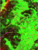 Transplantation of Cultured Myoblasts Into Intact Skeletal Muscle and Analysis of Muscle Contraction Force in Mice Model