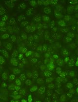 Protocol for Quantifying γH2AX Foci in Irradiated Cells Using Immunofluorescence and Fiji Software