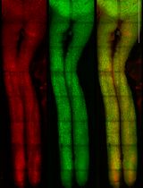 Intravitreal NHS-Biotin Injection and Immunohistochemistry to Label and Image Protein Transport in the Mouse Optic Nerve