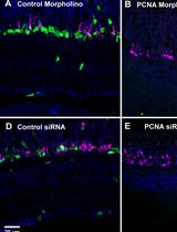 Efficient Gene Knockdown in Adult Zebrafish Retina by Intravitreal Injection