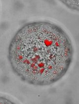 A Model of Breast Cancer Micrometastasis in a Three-Dimensional (3D) Liver Spheroid for Testing an Antimetastatic Therapy