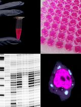 Enhancement of RNA Imaging Platforms by the Use of Peptide Nucleic Acid-Based Linkers