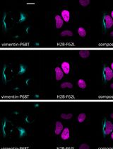 Fluorescence Lifetime-Based Separation of FAST-Labeled Cellular Compartment