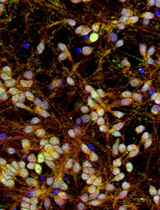 Rapid and Simplified Induction of Spinal Motor Neurons From Human Induced Pluripotent Stem Cells