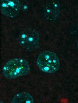 Colocalizing Telomeres With PML or γH2AX Foci by IF-FISH in Mouse Brain Neurons