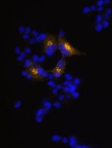 Generation of Insulin-Producing Alpha TC1-6 Cells Using EpiCRISPR System for Targeted DNA Methylation