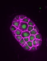 SunTag-Based Single-Molecule Translation Imaging in Caenorhabditis elegans