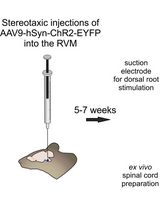 Optogenetic Approach for Investigating Descending Control of Nociception in Ex Vivo Spinal Cord Preparation